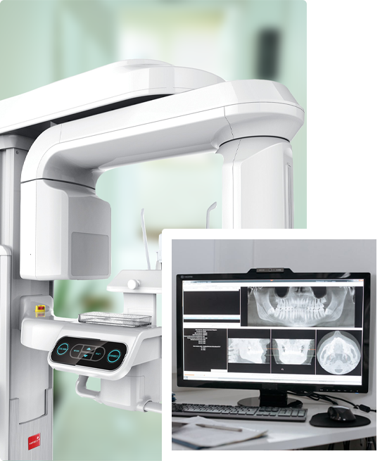 sippacs-pacs-radiology-sonograghy-graphic-software